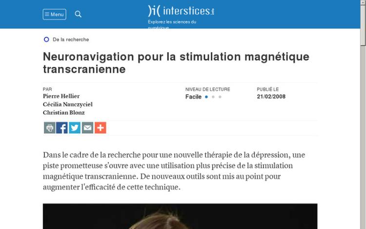 Accédez à la ressource pédagogique Neuronavigation pour la stimulation magnétique transcranienne